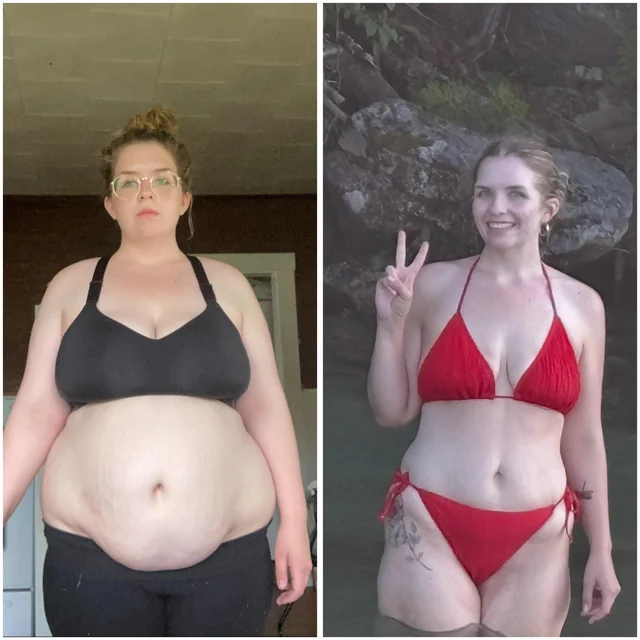 Before and After - Emma